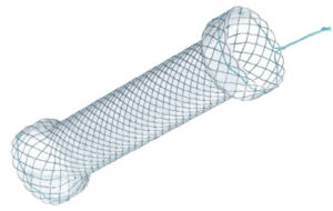 esophageal S-Type Stent