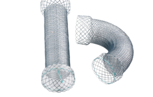 Colonic S-Type Stent