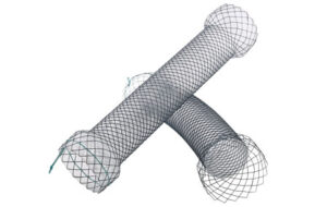 Pyloric S-Type Stent