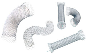 stents